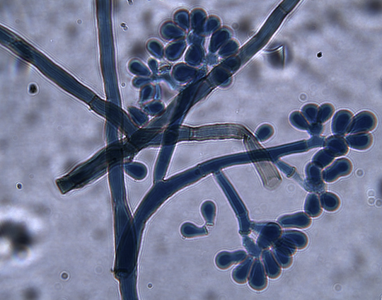 Imagen de la galería del Laboratorio de Fitopatología Frutal y Molecular: image13